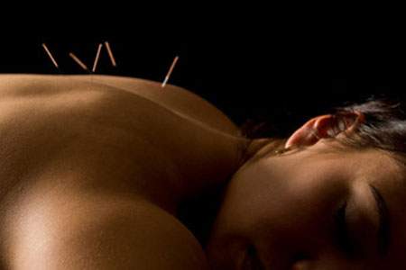 Akupunktur - Hausarztpraxis Dr-Lechelt