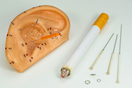 Akupunktur zur raucherentwönung
